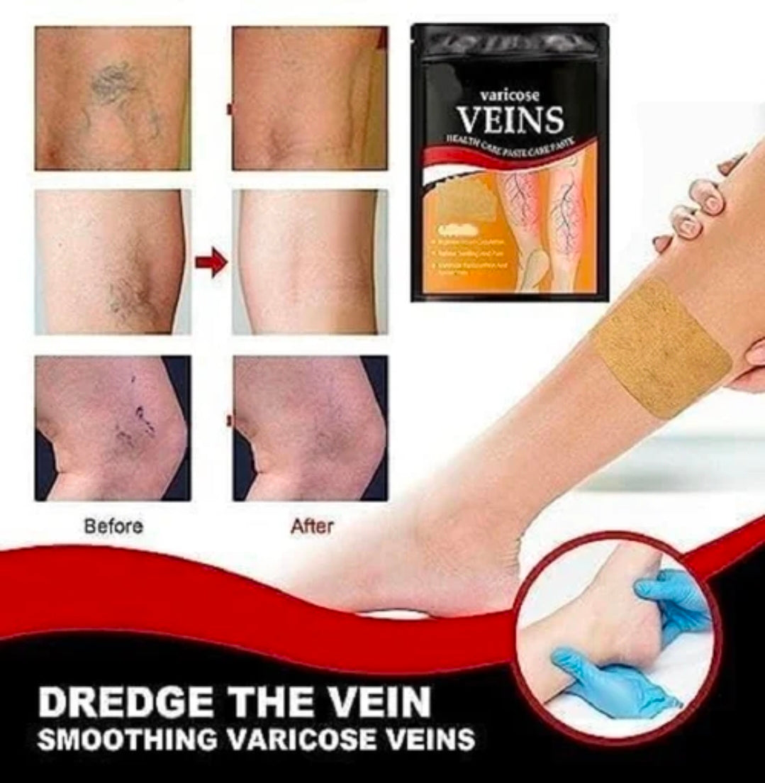Varicose Veins Patches
