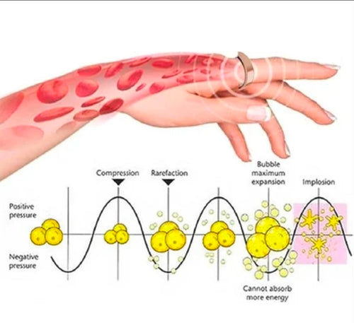Blood Sugar Control Magnetic Ring